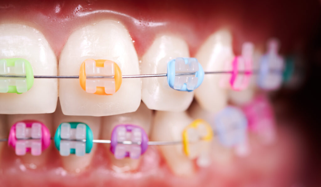 Медицинская история про посещение ортодонта